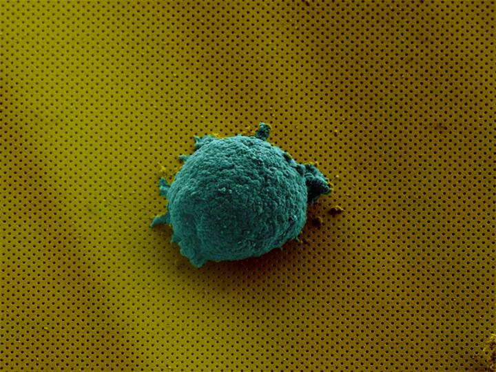 Lymphoma Cell on Biosensor