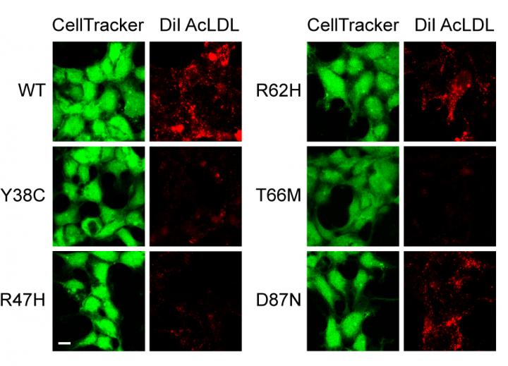 Cells with Mutant TREM2