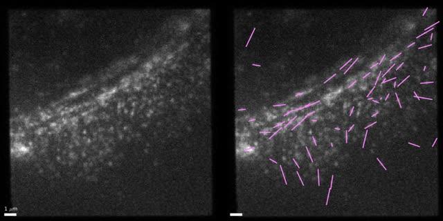 Orientation of Actin Filaments Imaged in Live Cells (2 of 2)