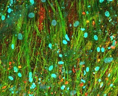 Bioengineered 3-Dimensional Brain Tissue