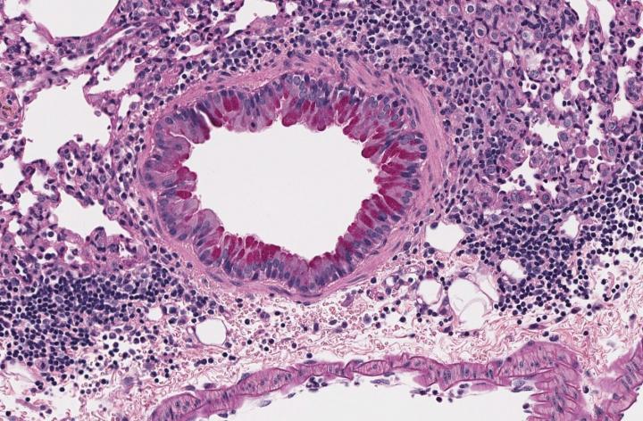 Gut Fungus Exacerbates Asthma in Antibiotic-Treated Mice