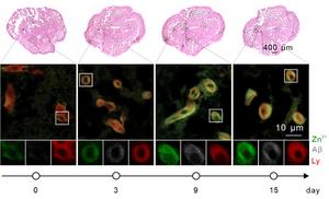 Zn2+ tracking in the brain of Alzheimer’s Disease model zebrafish.