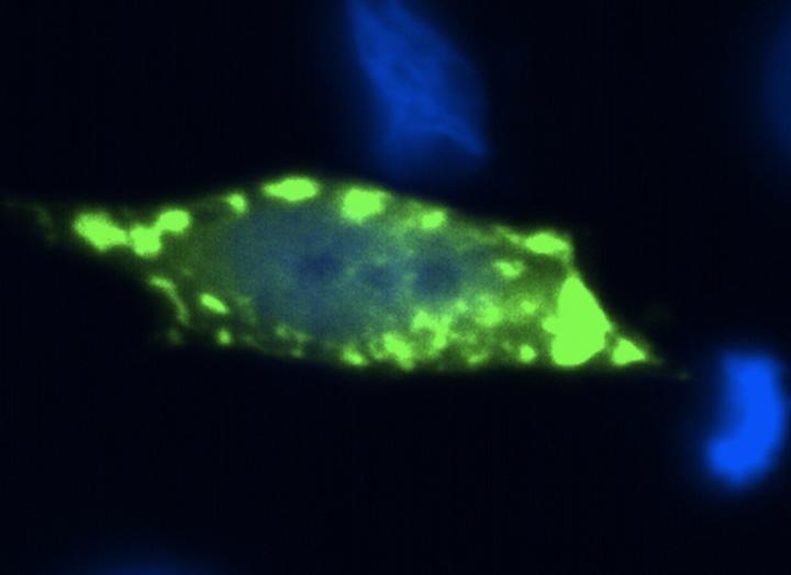 Aggregates of the Protein Sod1