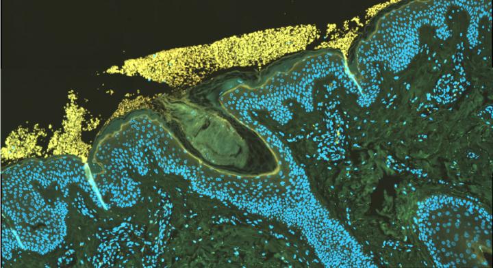 Cross-Section of Human Skin