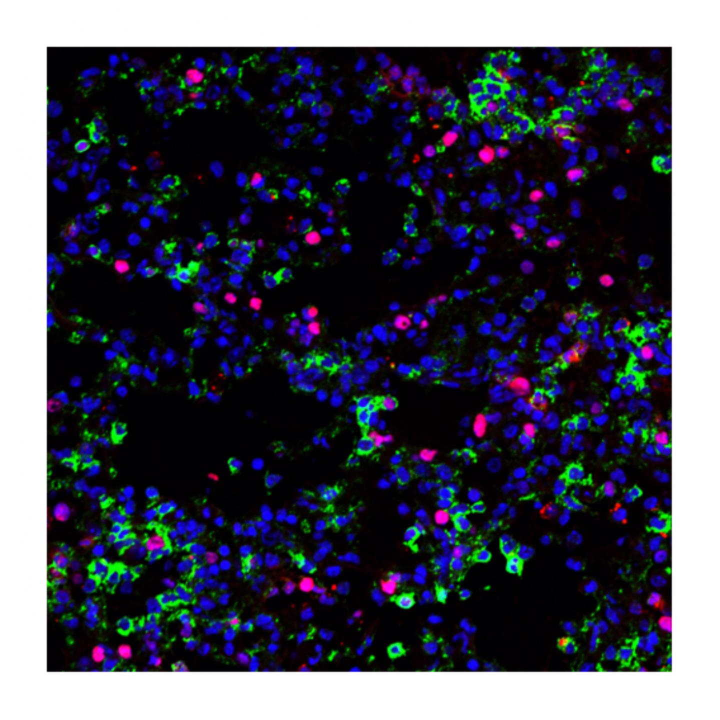 Macrophages Proliferation in the Lungs