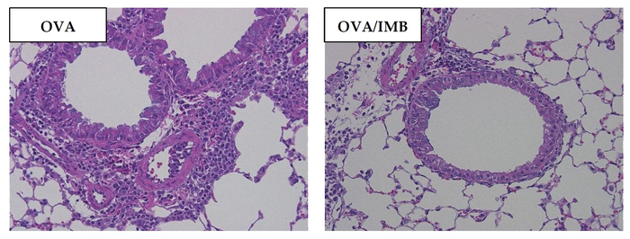 Representative images of lung tissues with HE staining