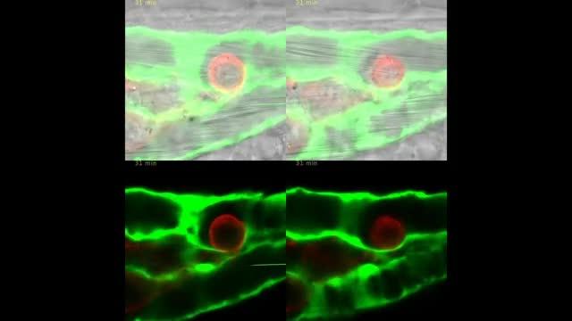 Blood Flow and Metastasis