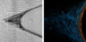 Cells progressively fill the cleft with new tissue, starting at the apex on the left. Myofibroblasts at the growth front are highlighted in orange.