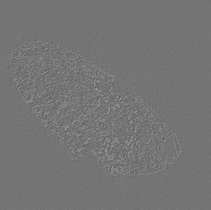 Image of Horsegram Seed