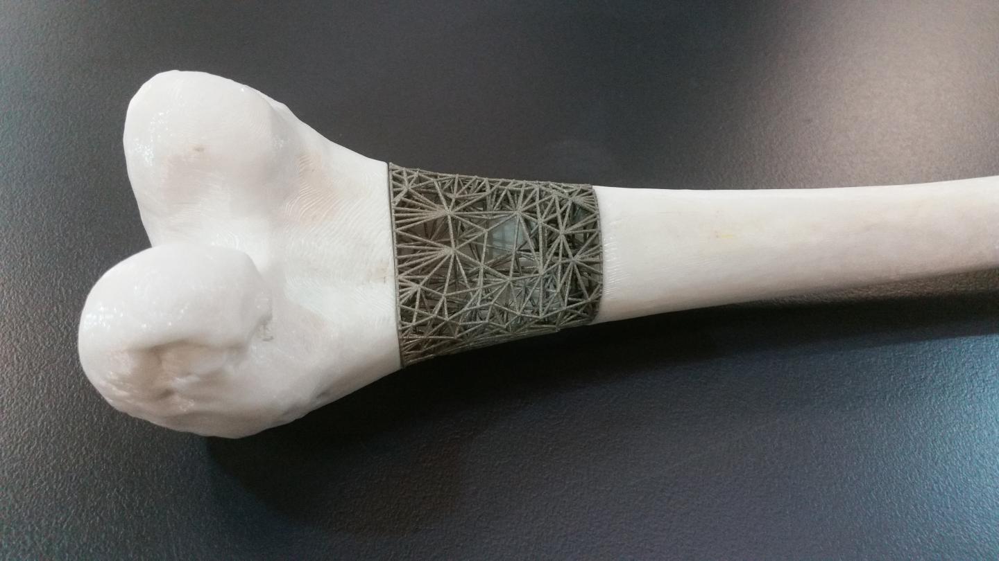 3D-printed Element Inserted into Bone. #1