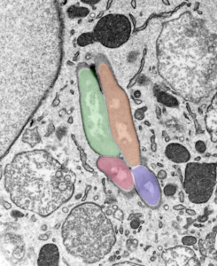 Image showing a macrophage infected with several M. tuberculosis bacilli