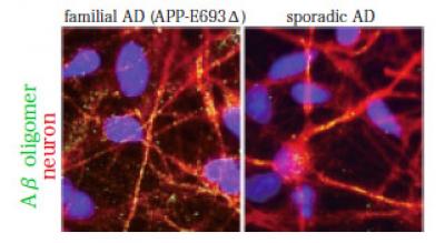 Amyloid Beta Oligomers in Neurons
