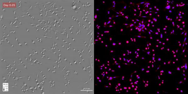 GLIM and PCIS image