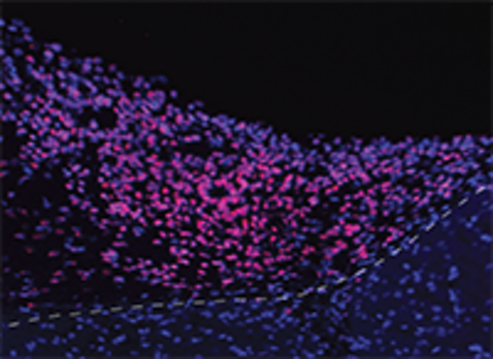 Border between a transplanted human brain organoid and mouse brain