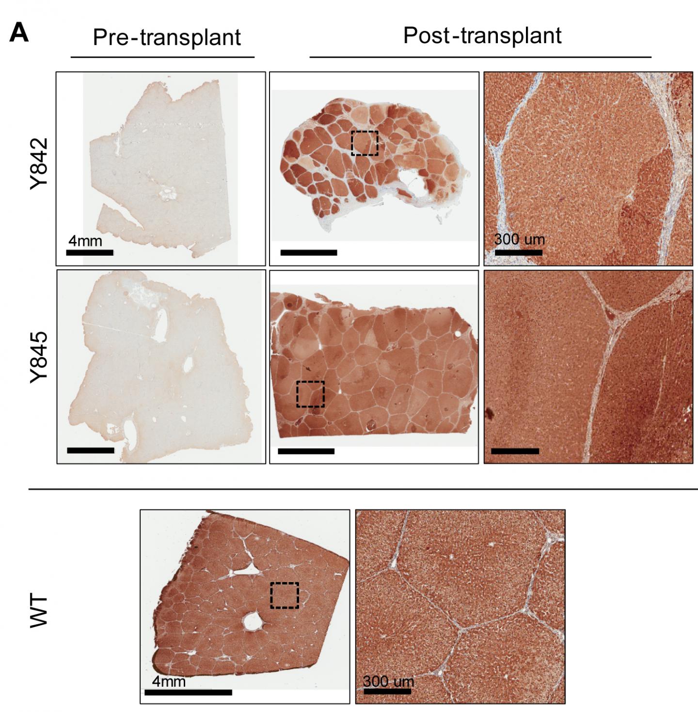 Gene Therapy Regenerates Diseased Liver in Pigs (2 of 3)