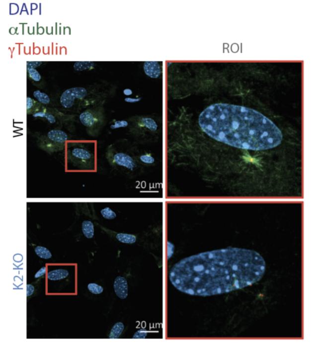 Podocytes