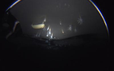 A New Species of Sea Anemone Living in the Underside of the Ross Ice Shelf, Antarctica