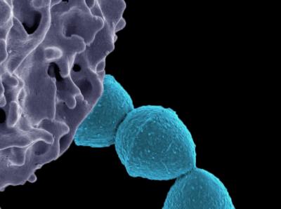 Cytotoxins Contribute to Virulence of Deadly Epidemic Bacterial Infections