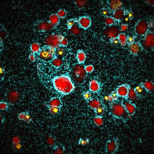 cholera-pathogen  and immune cells