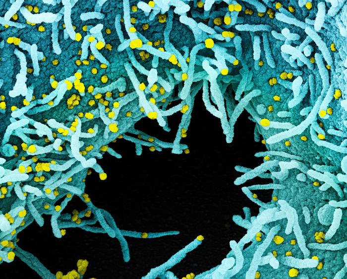A scanning electron micrograph of a cell heavily infected with SARS-CoV-2 virus particles