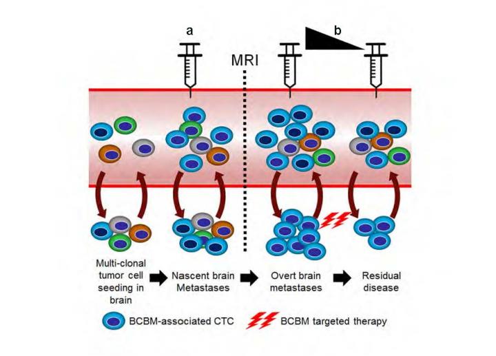 CTC Testing for BCBM Patients [IMAGE] | EurekAlert! Science News Releases