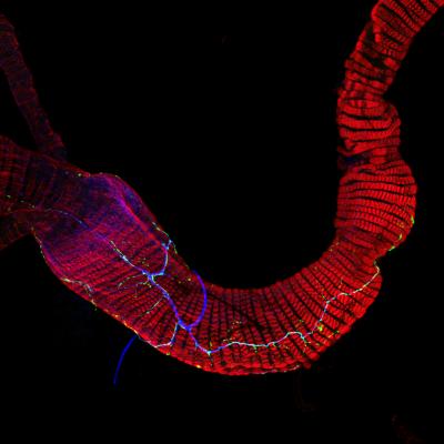 Nerve Cells in the Gut of the <I>Drosophila melanogaster</I> (1 of 3)