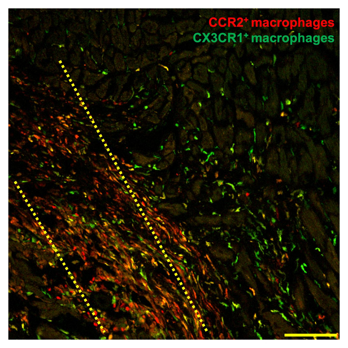 Macrophages to the Rescue