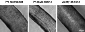 Novel bioink capable of constructing physiological blood vessels - EurekAlert