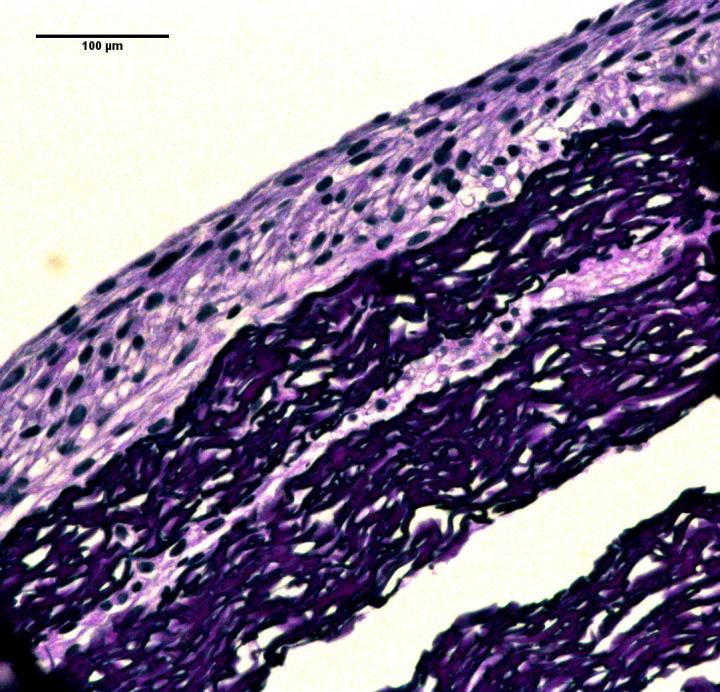 Biomimetic Vascular Graft