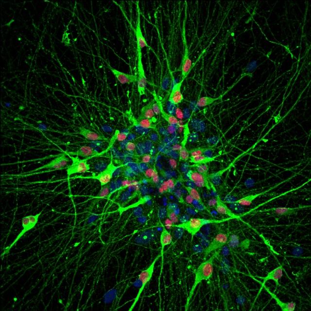 Serotonin-Producing Neurons