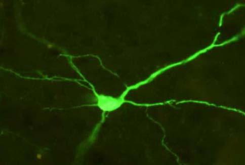 Cortical Neuron Expressing a Fluorescent Green Reporter Protein