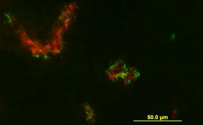 IF7 Peptide Targets Tumor Blood Vessels