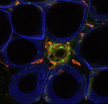 Fat Cells, Alan Saltiel Lab, UC San Diego School of Medicine