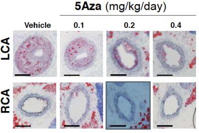 Effects of 5aza on Atherosclerosis Model