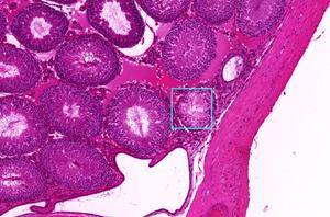 Testis tubule atrophy