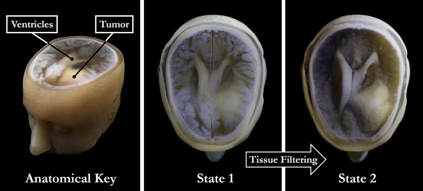 Biomedical 3D Printing Model