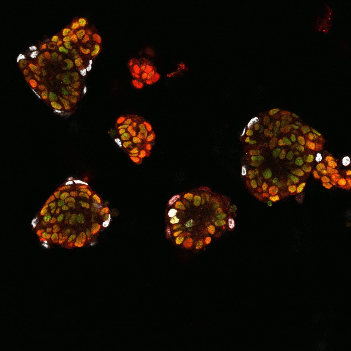 Embryonic Stem Cells Embarking on Differentiation