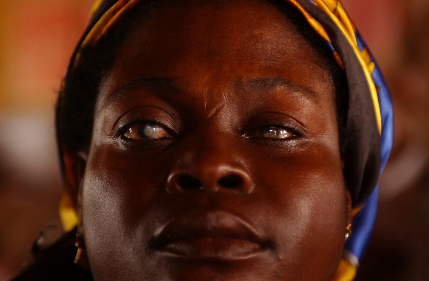 Woman with Cataracts in Ghana