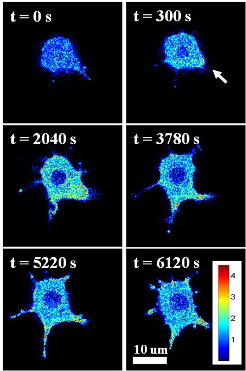 Macrophage Imaging