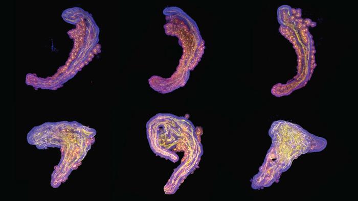 Collage of stem-cell-based embryo models