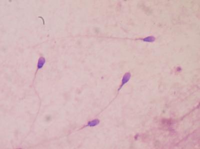 Human Spermatozoa Stained to Examine Seminal Quality