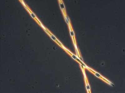 Pseudo-Nitzschia Diatom