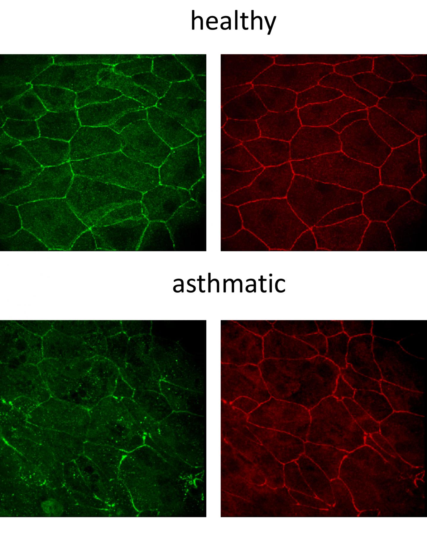 Epithelial Barriers