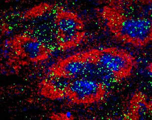 The immune system’s T cells (green) helping B cells (in the red zone) to make antibody responses inside the spleen. Credit Garvan