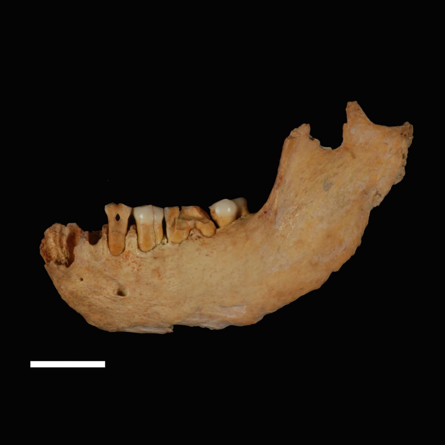Lower Jaw