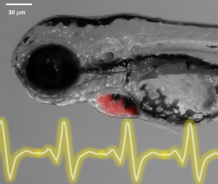 Zebrafish Embryo