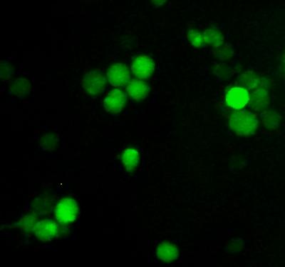 Kaposi Sarcoma-associated Herpesvirus