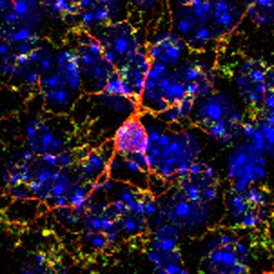 Single Microglia Cell in the Brain