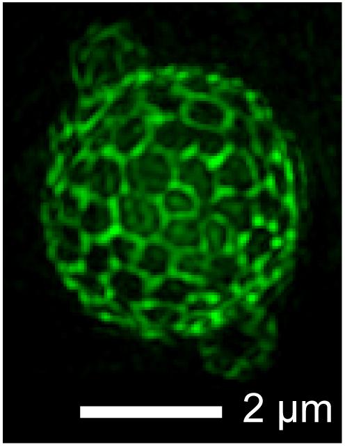 Phase Separation in Membrane of Living Yeast Cell