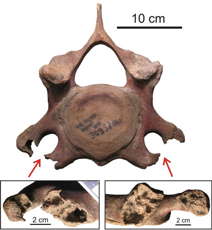 Openness of the Transverse Apertures of the Cervical Vertebrae